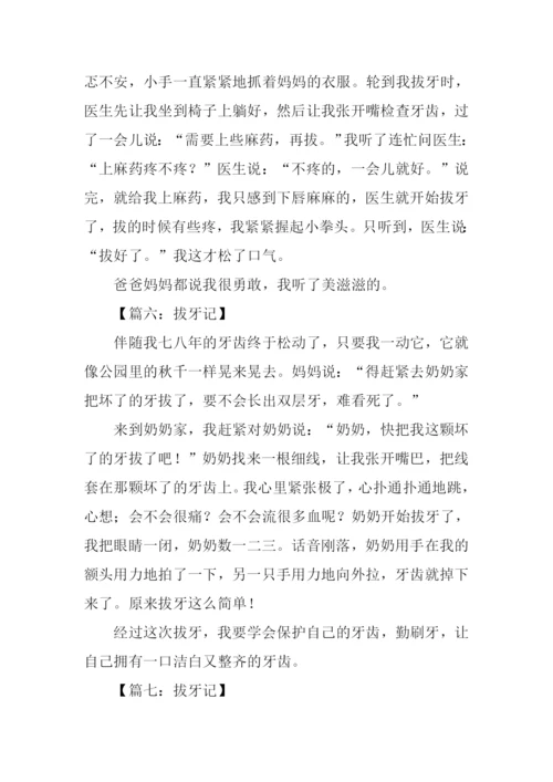 拔牙记作文300字.docx