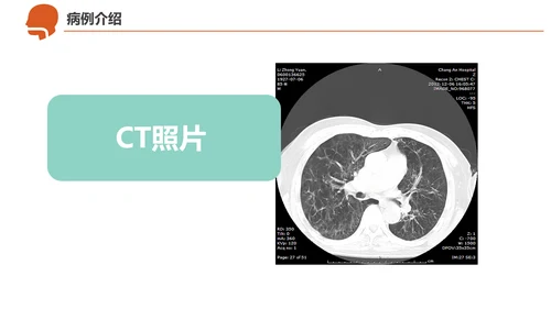 急诊急救工作呼吸衰竭病例创救患者PPT模板