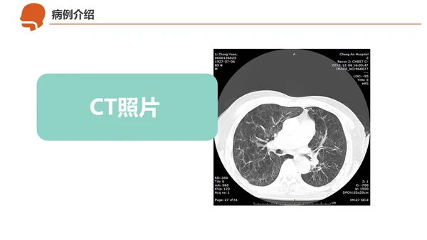 急诊急救工作呼吸衰竭病例创救患者PPT模板