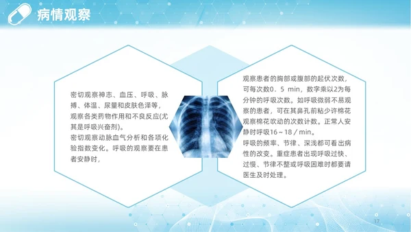 蓝色渐变简约商务呼吸困难的护理医学护理肺部培训PPT模板呼吸衰竭