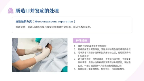 蓝紫色商务实拍造口护理培训PPT课件