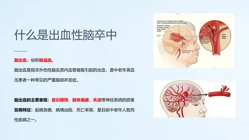 远离疾病预防高血压健康专题讲座PPT课件