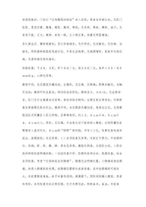 工艺条件对熔敷金属中扩散氢影响的试验研究.docx