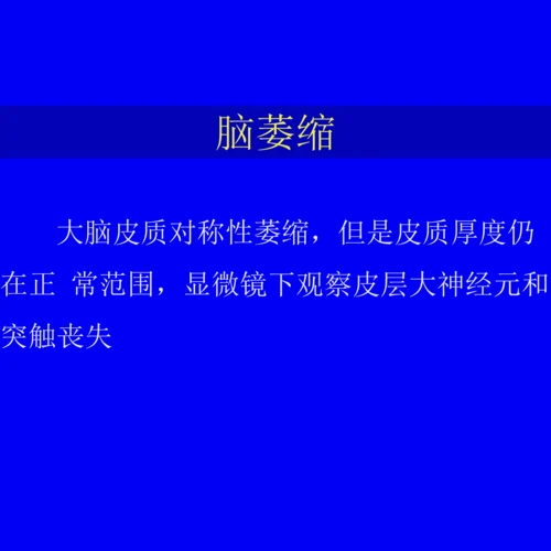 阿尔茨海默病(AD)的影像学诊断.docx