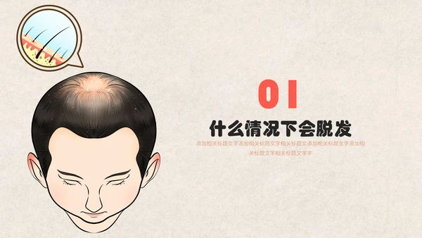 医疗健康预防脱发教学讲座通用PPT课件