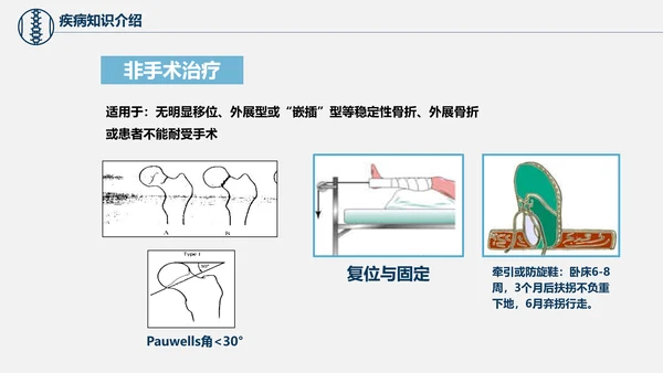 股骨颈骨折术后护理查房培训教学PPT课件