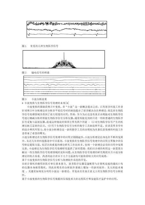 生物医学信号处理方法综述