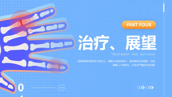 蓝色插画风股骨颈骨医护人员培训讲座医学护理PPT