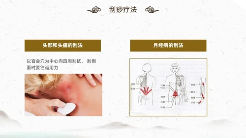中国风古风中医妇科外治法传统中医文化经络护理培训PPT