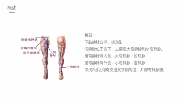 下肢静脉曲张护理专业教学PPT课件