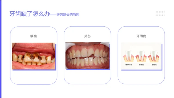 中青年口腔卫生牙料知识宣教PPT模板