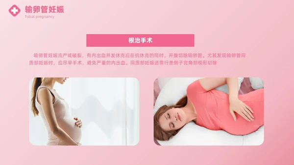 粉色实拍风异位妊娠的诊治医疗健康母婴孕妇培训PPT
