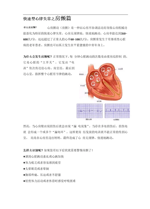 心律失常科普宣传手册