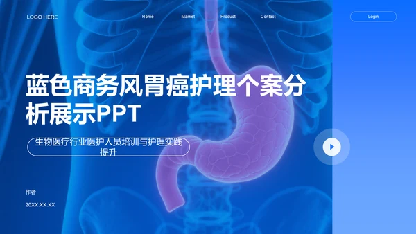蓝色商务风胃癌护理个案分析展示PPT