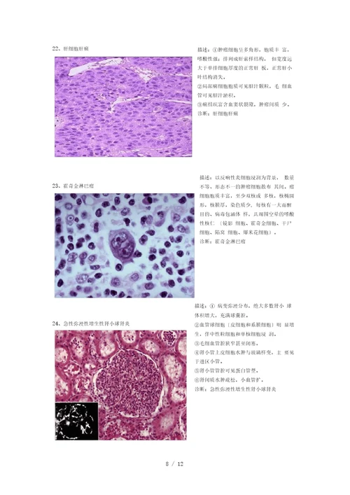 病理切片整理