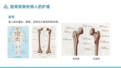 蓝色简约风股骨颈骨折护理查房培训课件