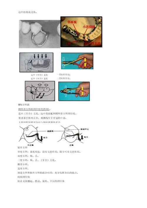 口腔主治医师考试专业实践能力口腔修复学牙列缺损修复