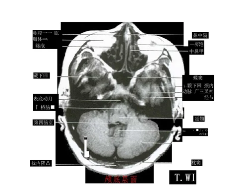 中枢神经系统断层影像