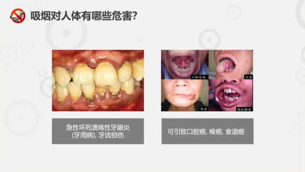 吸烟有害健康世界无烟日主题教育PPT课件