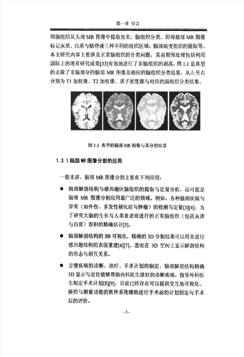 基于Gibbs随机场理论的脑部MR图像分割新算法研究生物医学工程专业论文