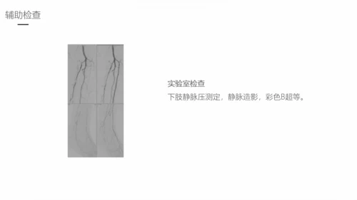 下肢静脉曲张护理专业教学PPT课件