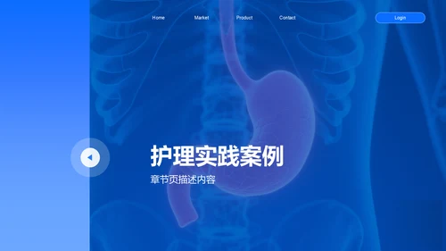 蓝色商务风胃癌护理个案分析展示PPT
