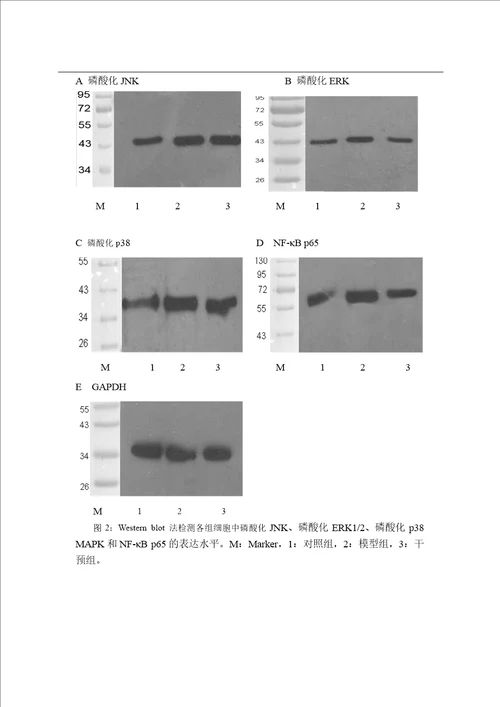 穿心莲内酯抑制小鼠腹腔巨噬细胞源性泡沫细胞中mapk的激活和nfb的表达