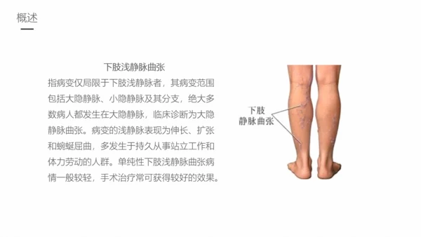 下肢静脉曲张护理专业教学PPT课件