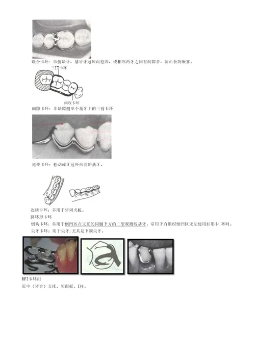 口腔主治医师考试专业实践能力口腔修复学牙列缺损修复
