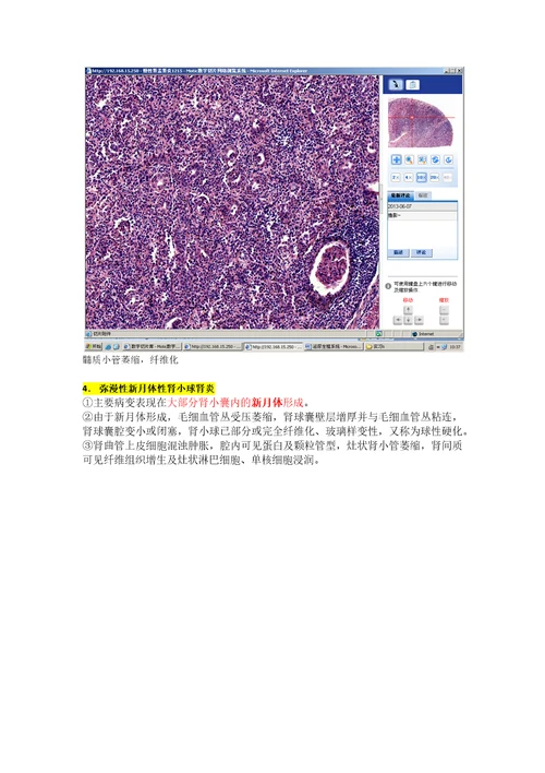 病理学各论切片：泌尿生殖系统