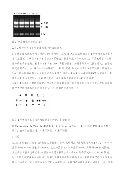 基因RASSF1B、RASSF1F在肿瘤细胞中转录表达及临床意义.docx