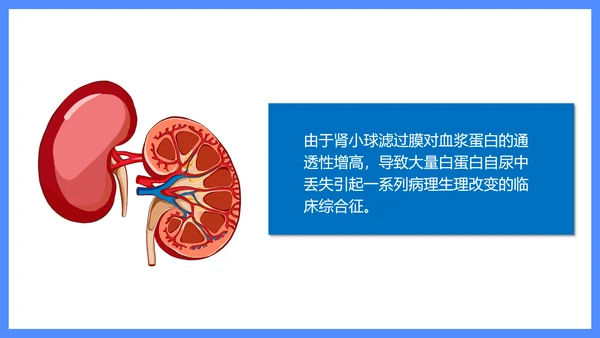 原发性肾病综合症医疗护理查房PPT课件模板