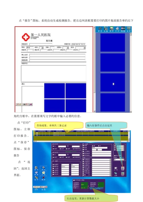 ZL502红外乳腺诊断仪操作专项说明书.docx