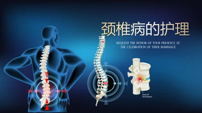 蓝色医疗颈椎病的护理动态PPT
