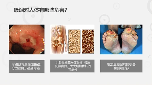 珍爱生命远离香烟世界无烟日通用PPT