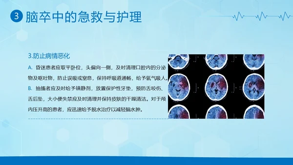 脑卒中急救护理中风急救中风预防中风护理PPT课件