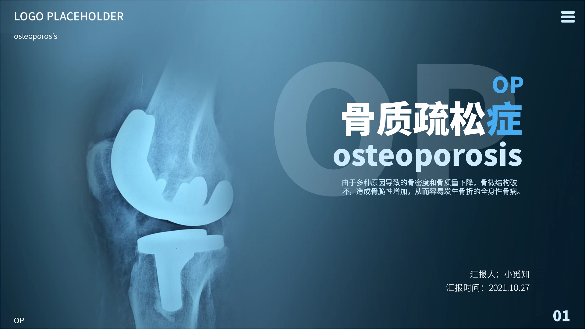 蓝马卡龙色简约老人医疗预防骨质疏松医疗健康知识汇报培训PPT