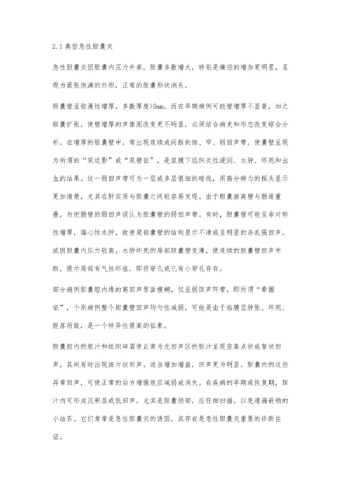 急性非结石性胆囊炎的超声表现.docx