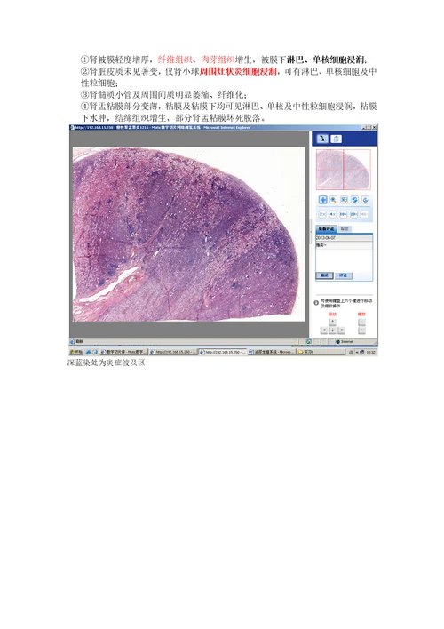 病理学各论切片：泌尿生殖系统