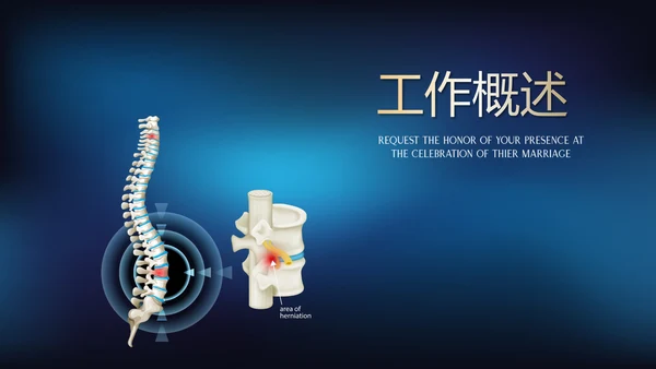 蓝色医疗颈椎病的护理动态PPT
