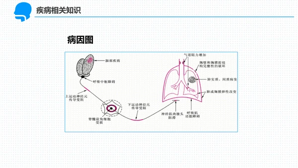 呼吸科护理查房PPT课件（呼吸衰竭）