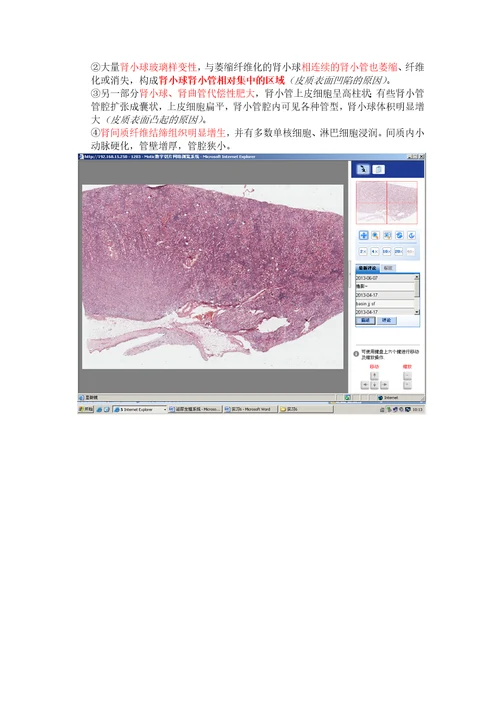 病理学各论切片：泌尿生殖系统