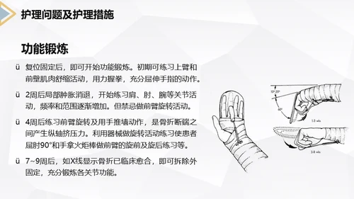 左桡尺骨双骨折护理查房通用PPT模板