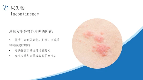 蓝色简约实拍风失禁性皮炎护理医护培训PPT课件