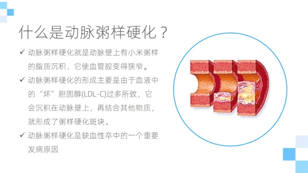 脑卒中健康科普通用PPT模板