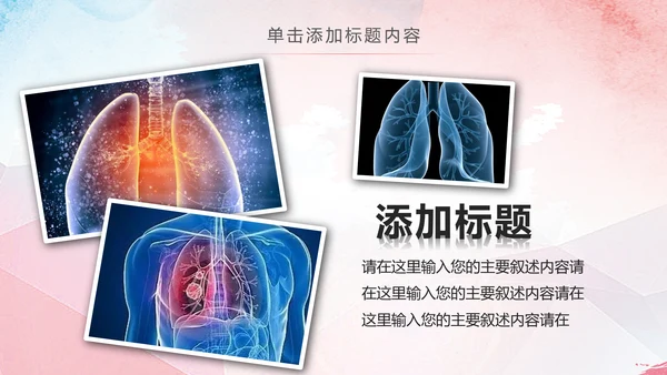 医疗肺结核肺病宣传动态PPT模板