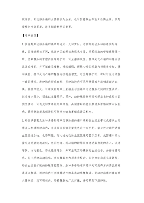 腹部动静脉瘘的超声诊断.docx