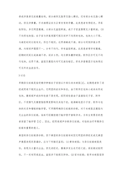 经阴道彩色多普勒超声对早期异位妊娠的临床诊断价值.docx