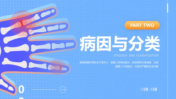 蓝色插画风股骨颈骨医护人员培训讲座医学护理PPT