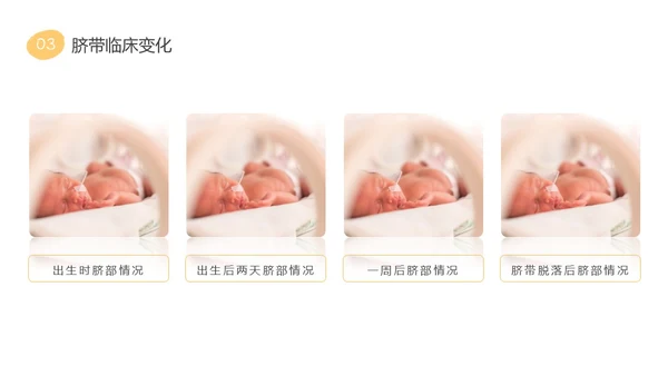 黄色粉色蓝色简约实拍新生儿脐部护理医护培训动态PPT